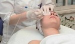 Лазерная шлифовка растяжек Лазерная шлифовка растяжек
